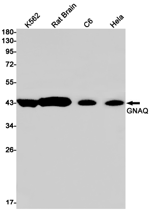 Rabbit Monoclonal Antibody to GNAQ