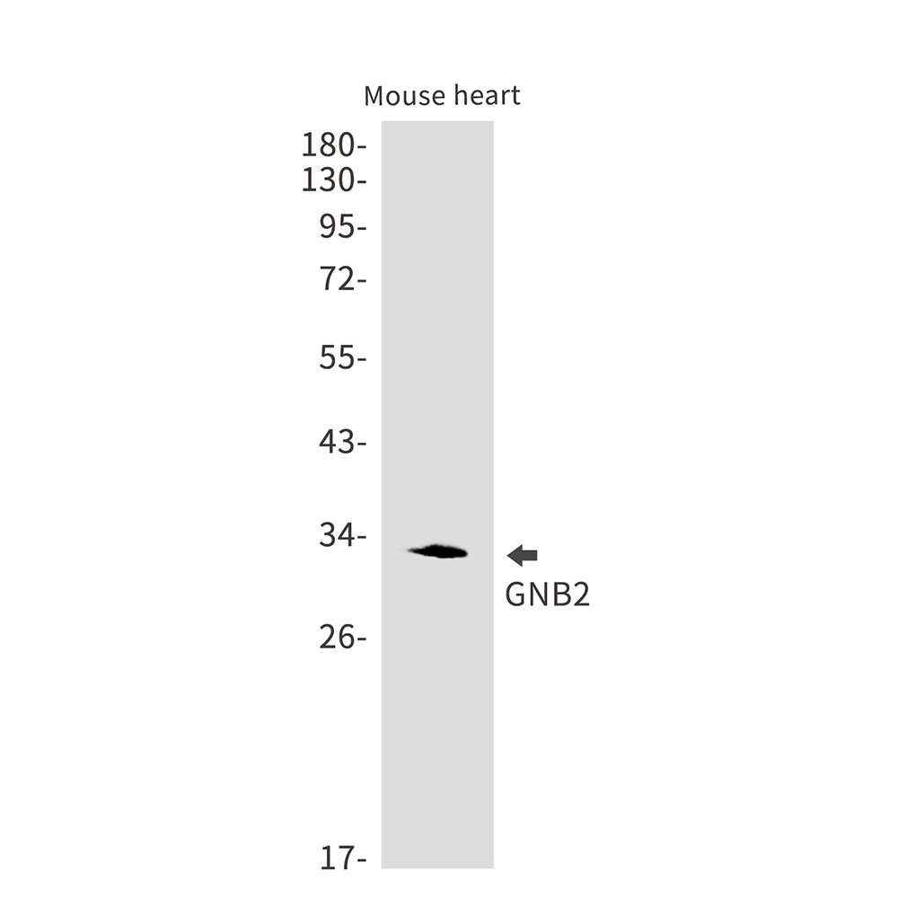 Rabbit Monoclonal Antibody to GNB2