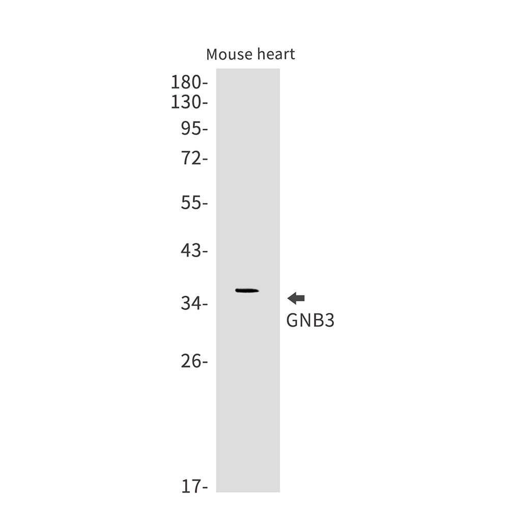 Rabbit Monoclonal Antibody to GNB3