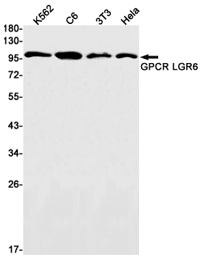 Rabbit Monoclonal Antibody to LGR6