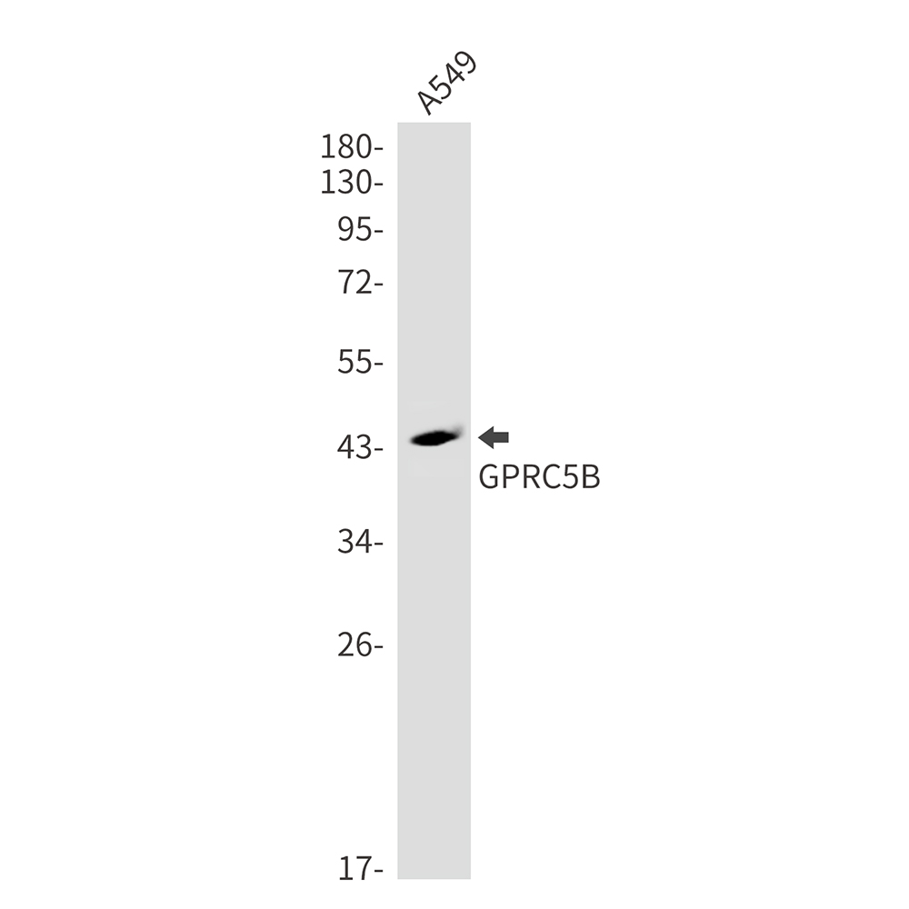 Rabbit Monoclonal Antibody to GPRC5B