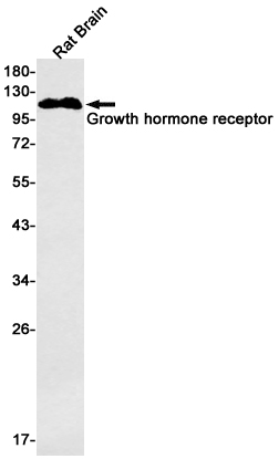 Rabbit Monoclonal Antibody to Growth Hormone Receptor