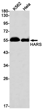 Rabbit Monoclonal Antibody to HARS