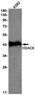 Rabbit Monoclonal Antibody to HDAC8