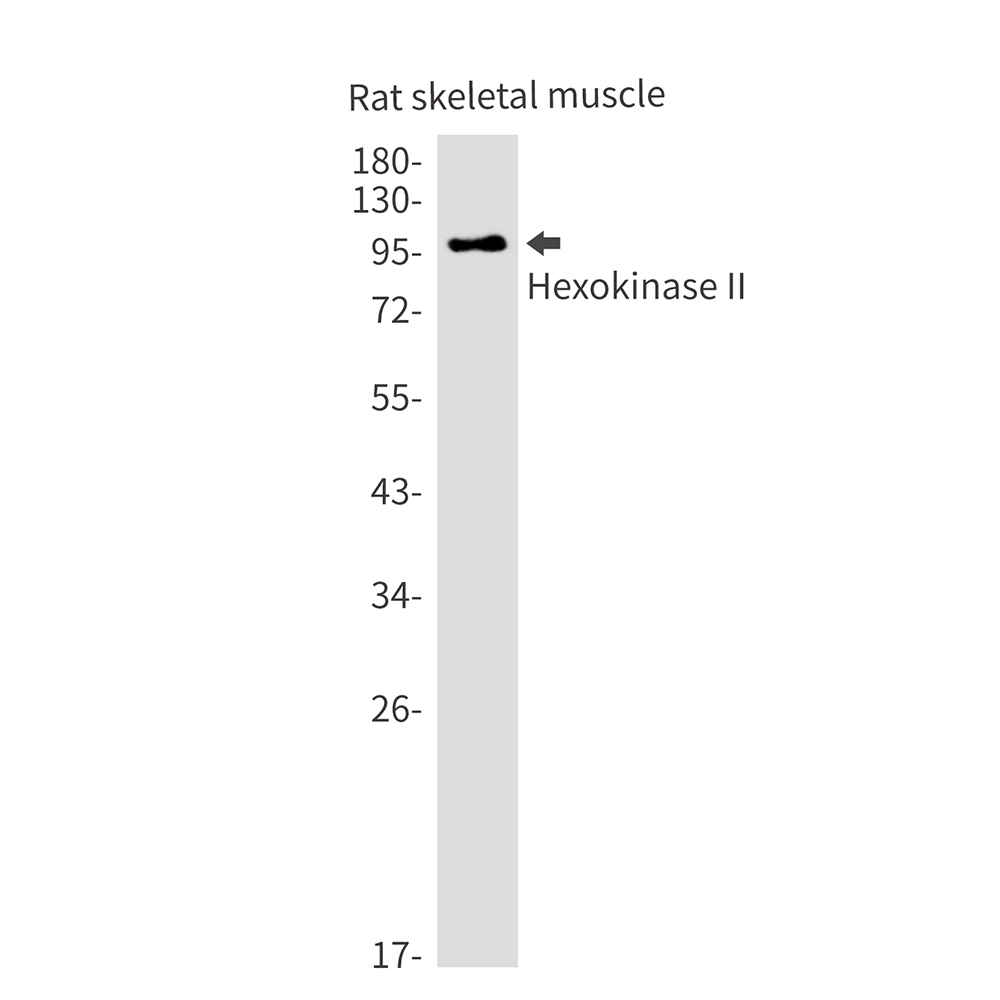 Rabbit Monoclonal Antibody to Hexokinase II