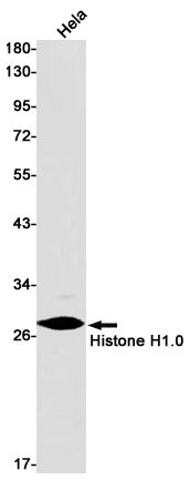 Rabbit Monoclonal Antibody to Histone H1.0