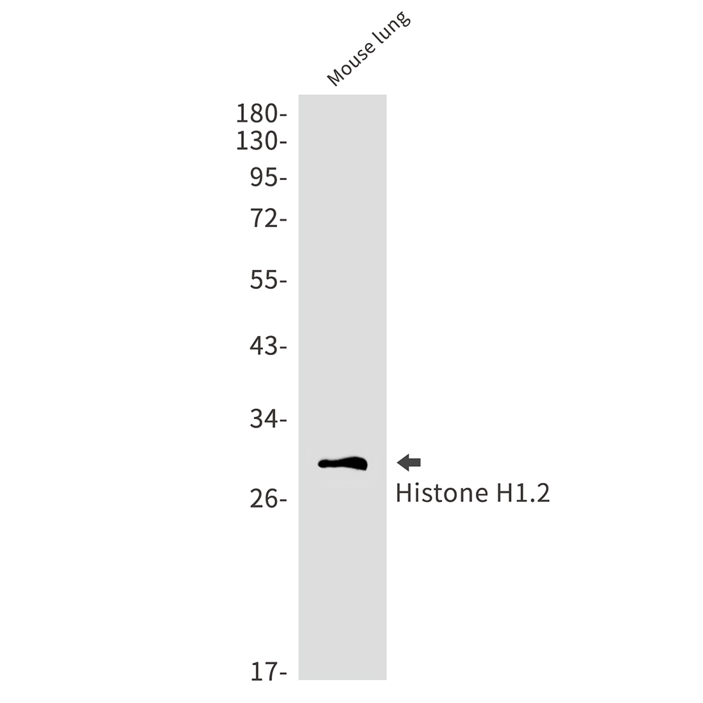 Rabbit Monoclonal Antibody to Histone H1.2