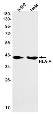 Rabbit Monoclonal Antibody to HLA A