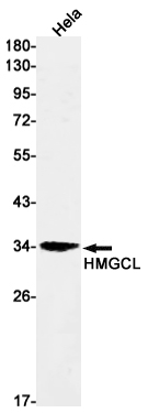 Rabbit Monoclonal Antibody to HMGCL