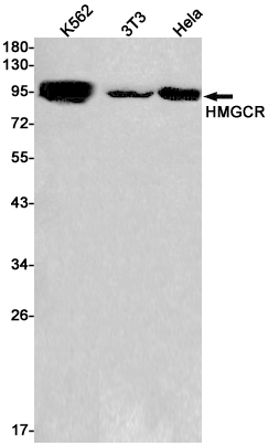 Rabbit Monoclonal Antibody to HMGCR