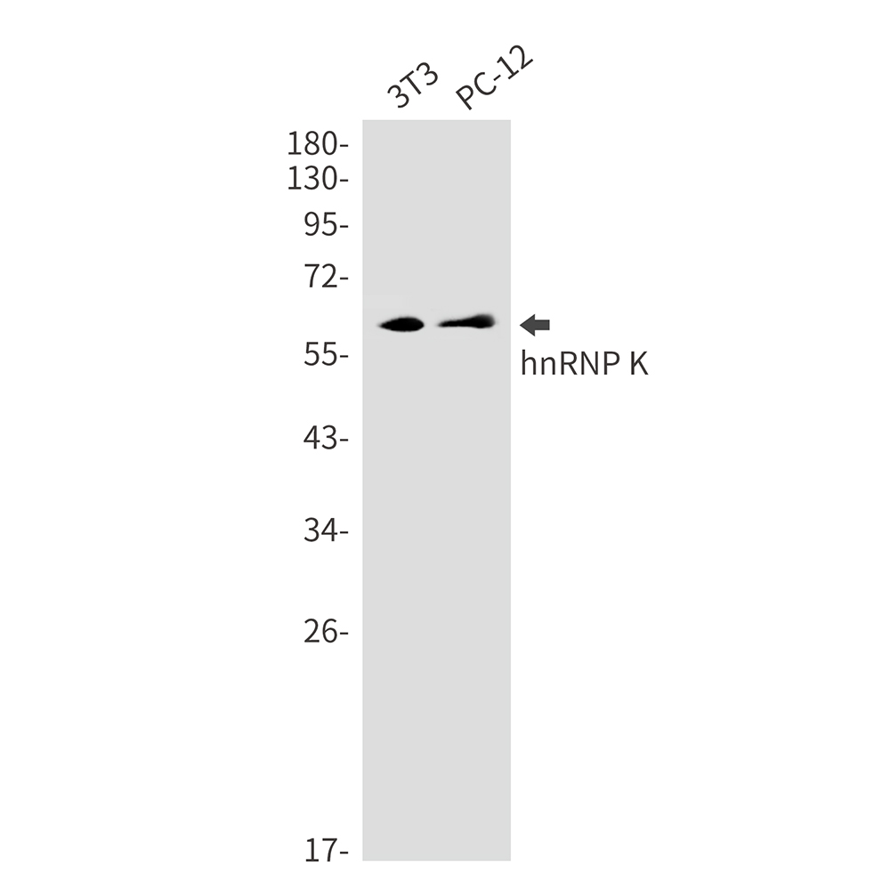 Rabbit Monoclonal Antibody to hnRNP K