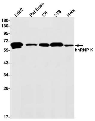Rabbit Monoclonal Antibody to hnRNP K