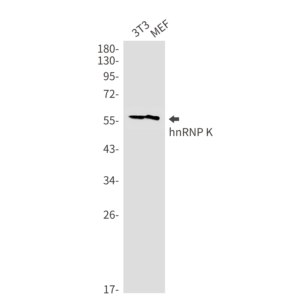 Rabbit Monoclonal Antibody to hnRNP K