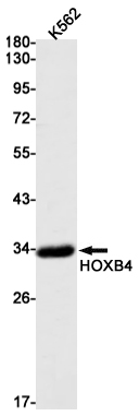 Rabbit Monoclonal Antibody to HOXB4