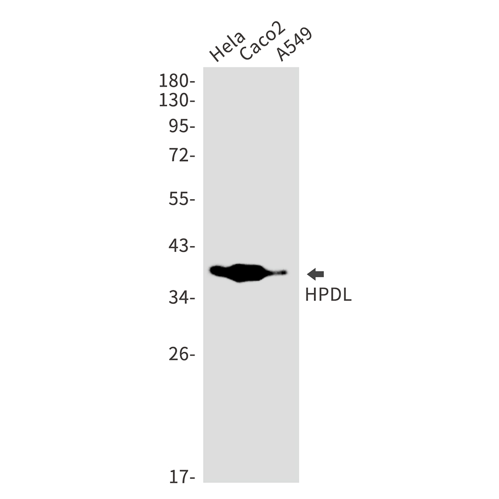 Rabbit Monoclonal Antibody to HPDL
