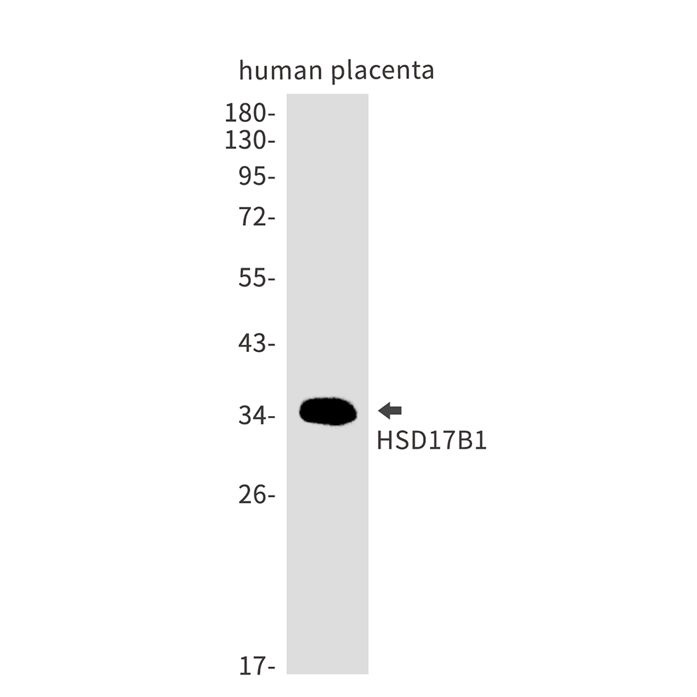 Rabbit Monoclonal Antibody to HSD17B1