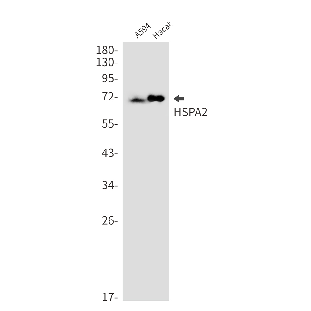 Rabbit Monoclonal Antibody to HspA2