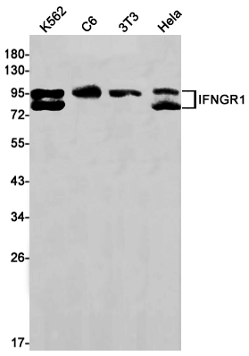 Rabbit Monoclonal Antibody to Interferon gamma Receptor 1