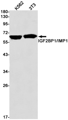 Rabbit Monoclonal Antibody to IGF2BP1