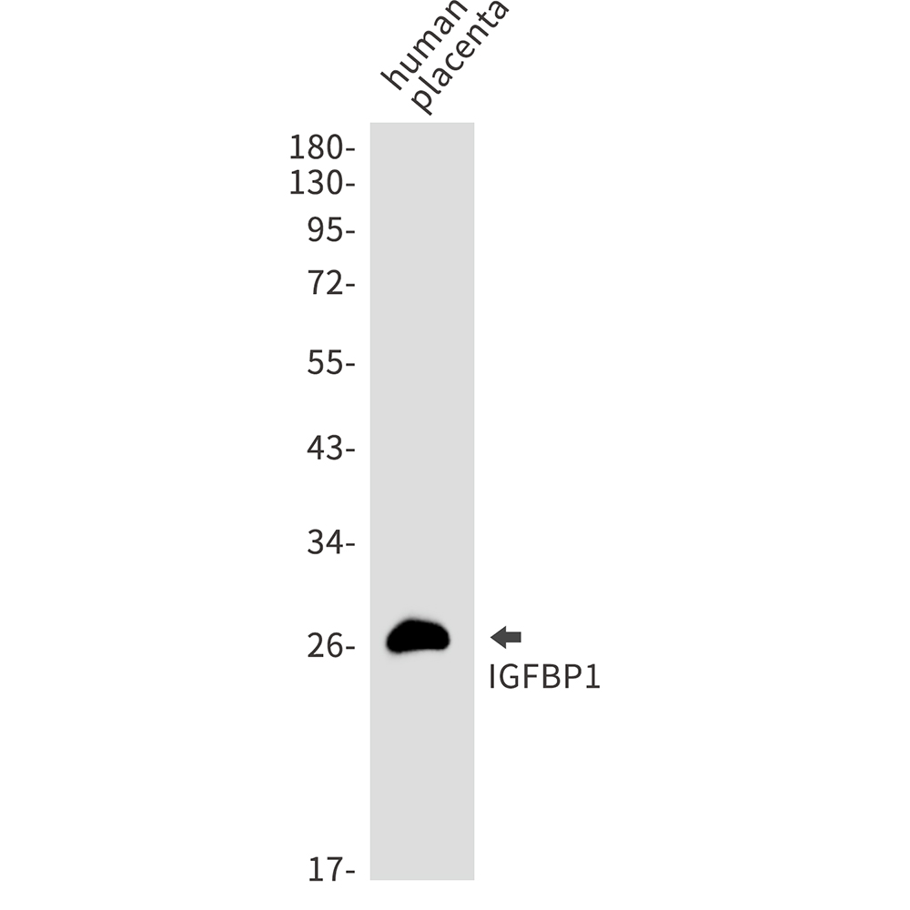 Rabbit Monoclonal Antibody to IGFBP1