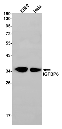 Rabbit Monoclonal Antibody to IGFBP6