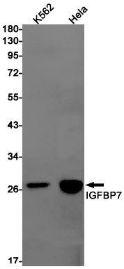Rabbit Monoclonal Antibody to IGFBP7