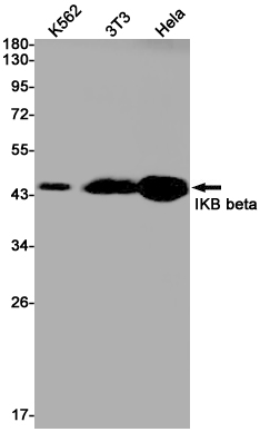Rabbit Monoclonal Antibody to IKB beta
