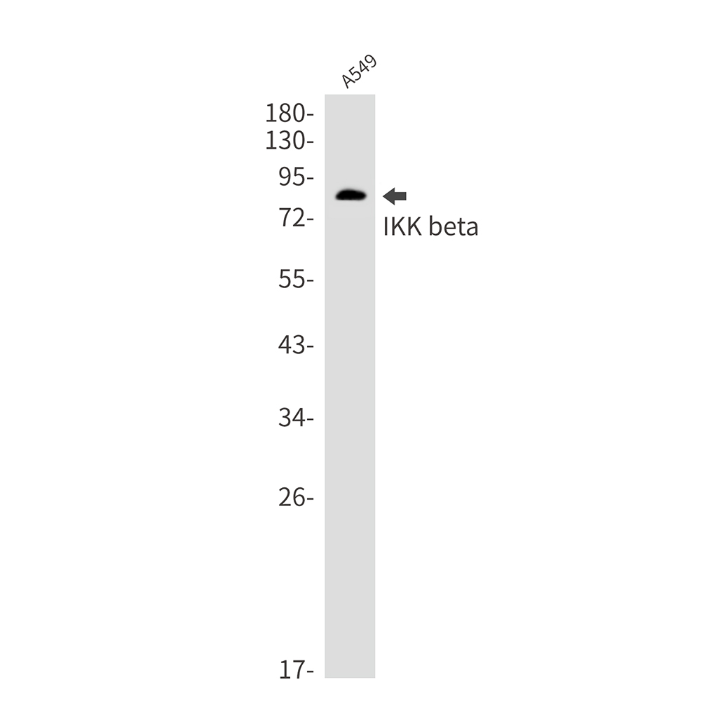 Rabbit Monoclonal Antibody to IKK beta