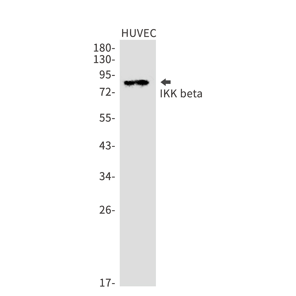 Rabbit Monoclonal Antibody to IKK beta