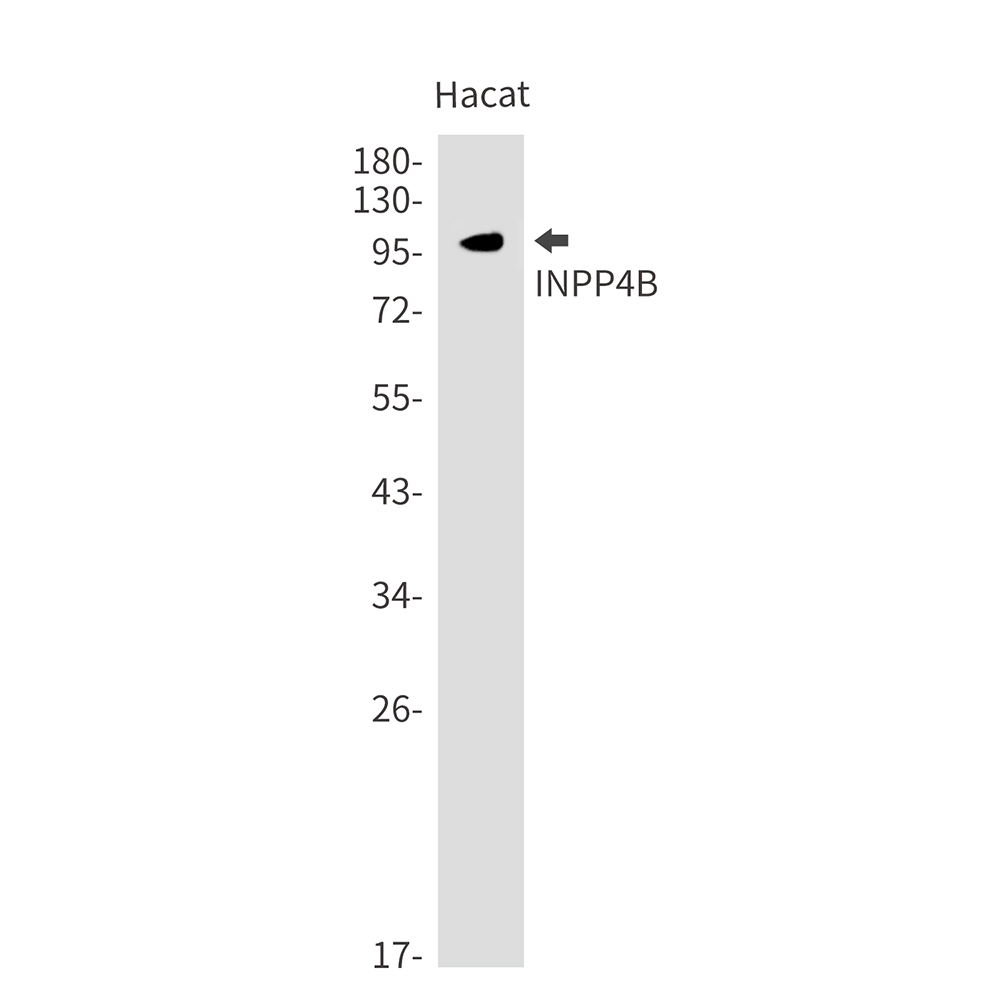 Rabbit Monoclonal Antibody to INPP4B