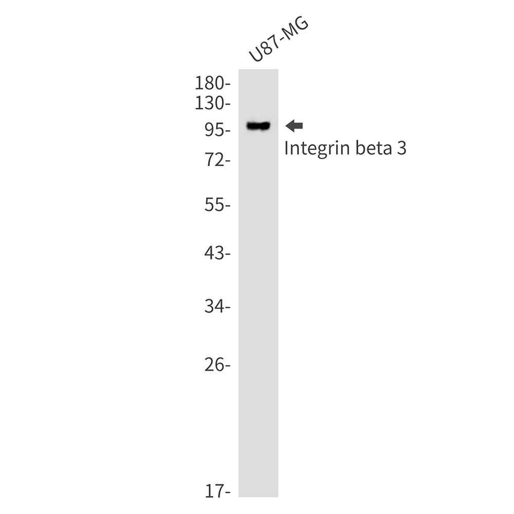 Rabbit Monoclonal Antibody to Integrin beta 3
