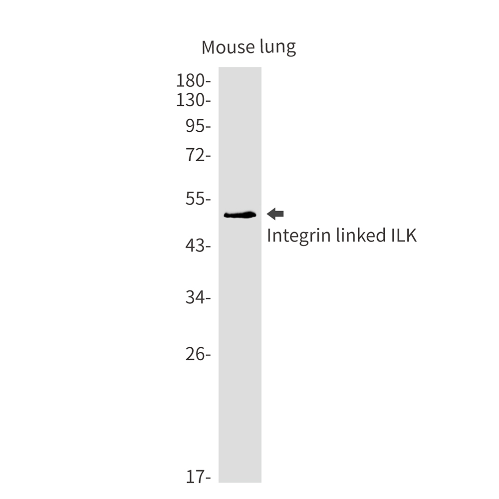 Rabbit Monoclonal Antibody to Integrin Linked ILK