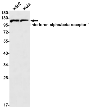 Rabbit Monoclonal Antibody to Interferon alpha/beta Receptor 1