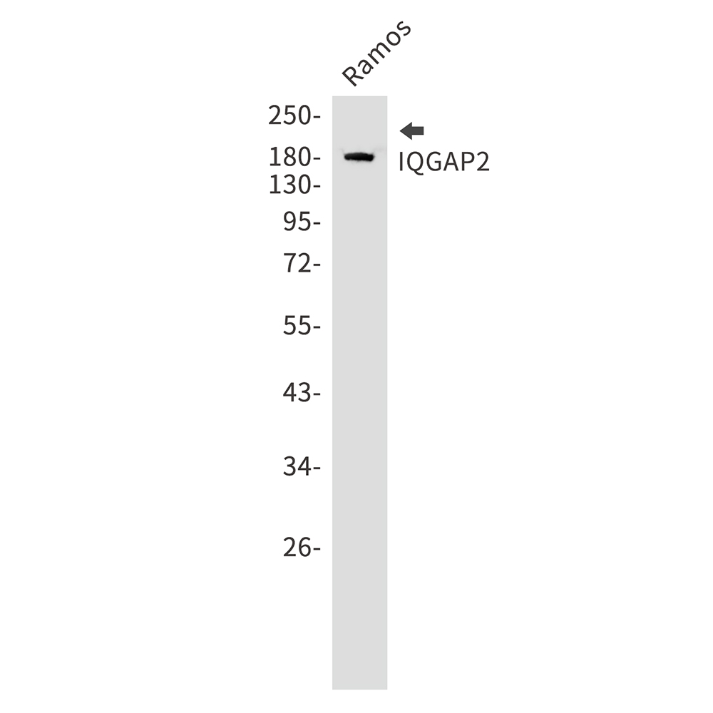 Rabbit Monoclonal Antibody to IQGAP2