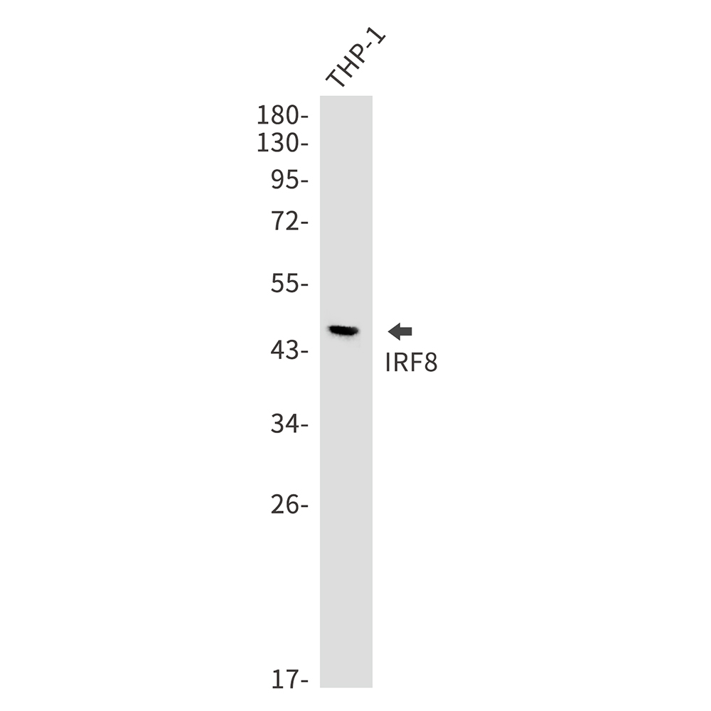 Rabbit Monoclonal Antibody to IRF8