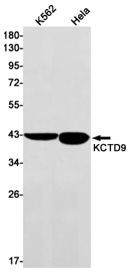 Rabbit Monoclonal Antibody to KCTD9