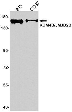 Rabbit Monoclonal Antibody to KDM4B