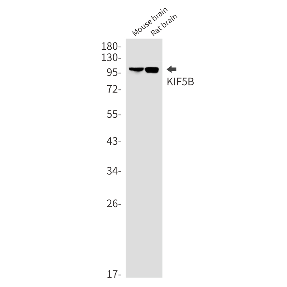 Rabbit Monoclonal Antibody to KIF5B