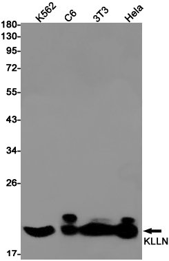 Rabbit Monoclonal Antibody to Killin