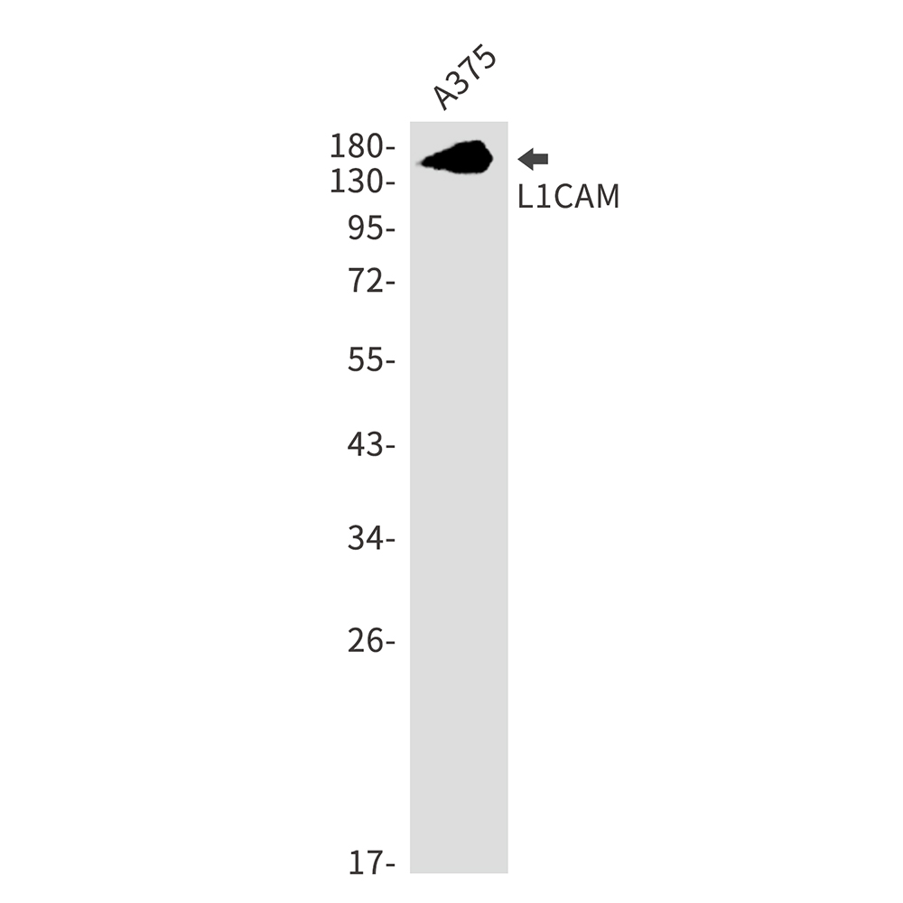 Rabbit Monoclonal Antibody to L1CAM