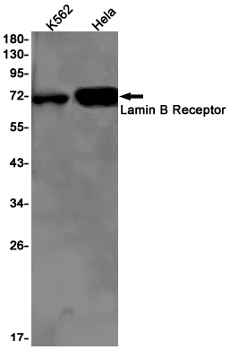Rabbit Monoclonal Antibody to Lamin B Receptor