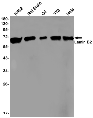 Rabbit Monoclonal Antibody to Lamin B2