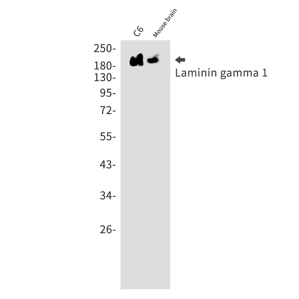 Rabbit Monoclonal Antibody to Laminin gamma 1
