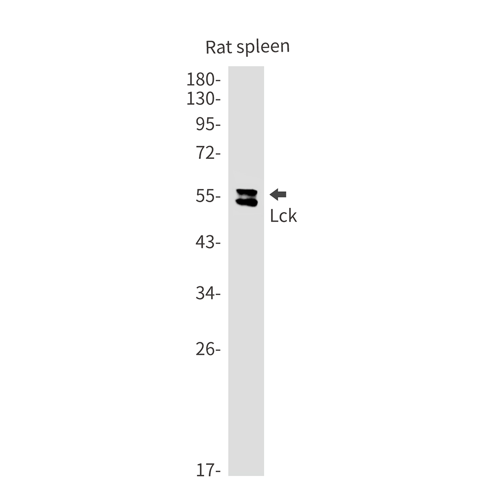 Rabbit Monoclonal Antibody to Lck