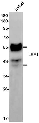 Rabbit Monoclonal Antibody to LEF1