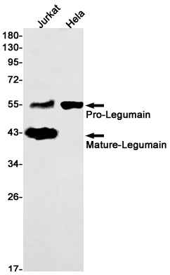 Rabbit Monoclonal Antibody to Legumain
