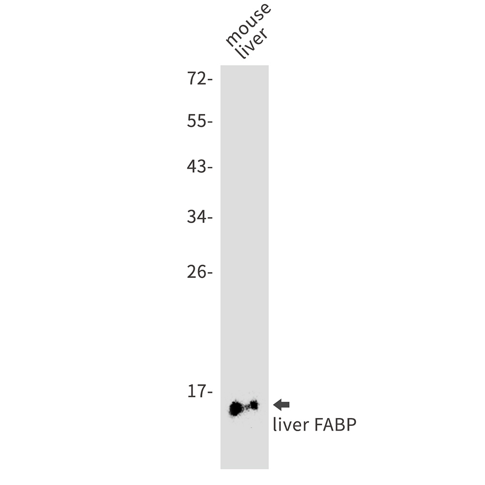 Rabbit Monoclonal Antibody to FABP1