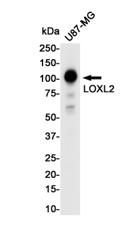 Rabbit Monoclonal Antibody to LOXL2