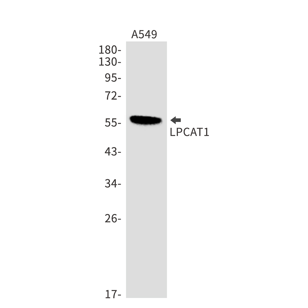 Rabbit Monoclonal Antibody to LPCAT1