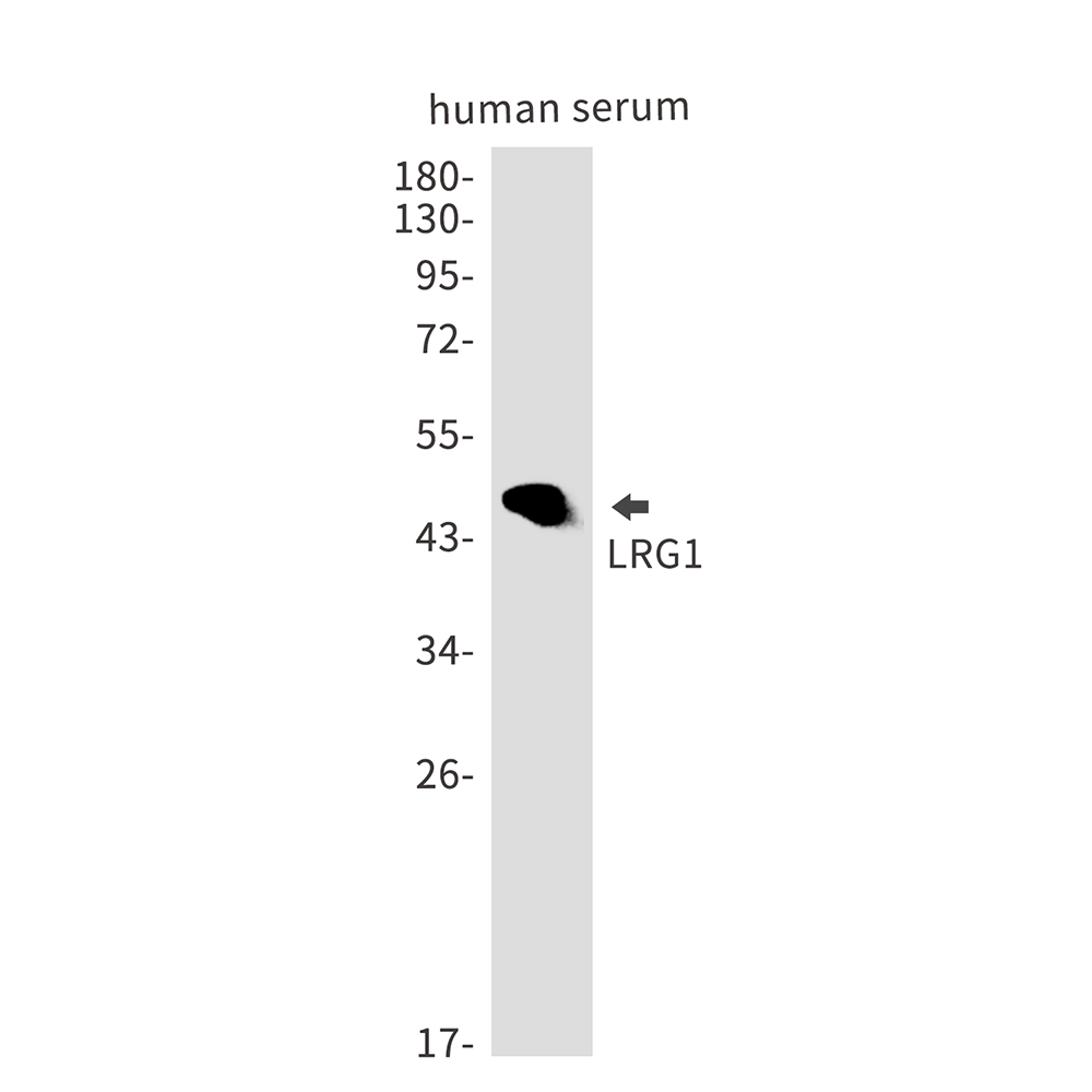 Rabbit Monoclonal Antibody to LRG1